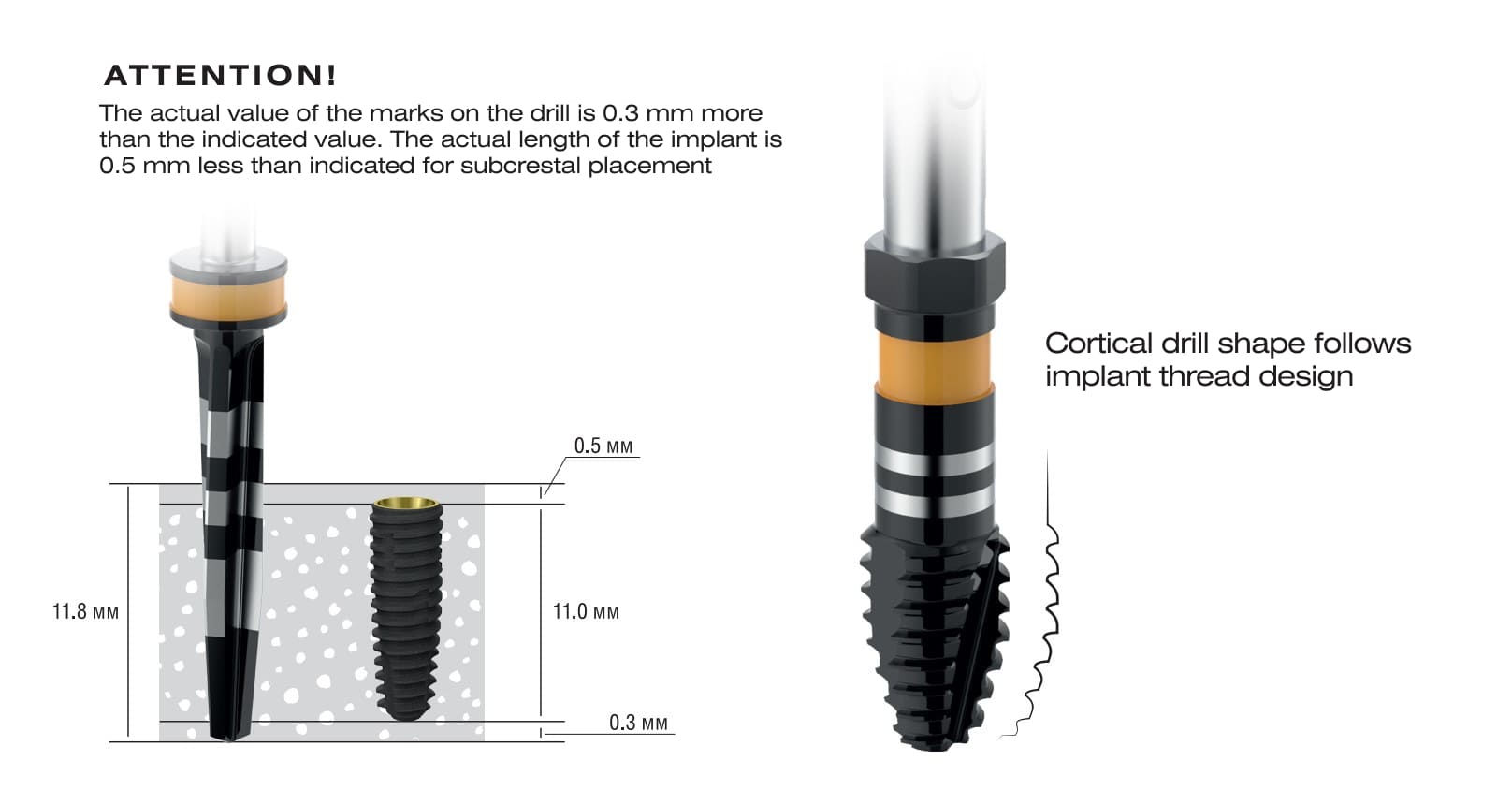 Asper form of cortical drill