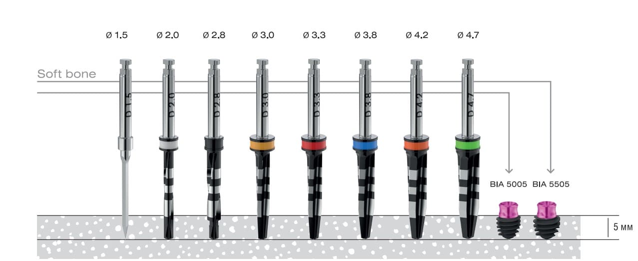 Asper 5mm installation protocol with a diameter of 5 mm and 5.5 mm